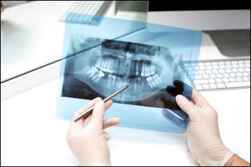 dental teleradiology service